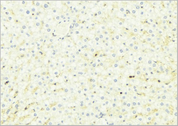 product-image-AAA31110_IHC2.jpg