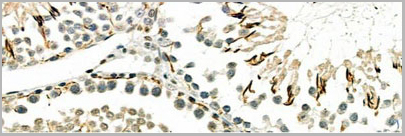 product-image-AAA31112_IHC3.jpg