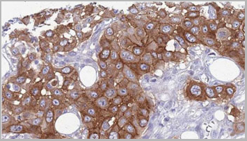 product-image-AAA31115_IHC3.jpg