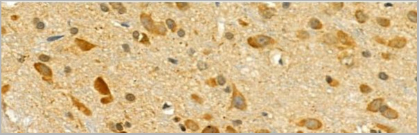 product-image-AAA31115_IHC4.jpg