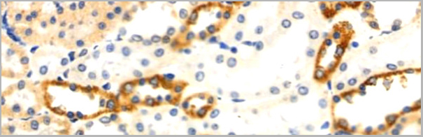 product-image-AAA31118_IHC4.jpg