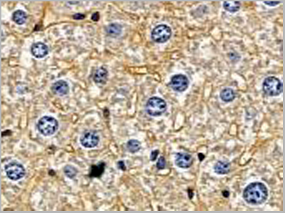 product-image-AAA31119_IHC3.png
