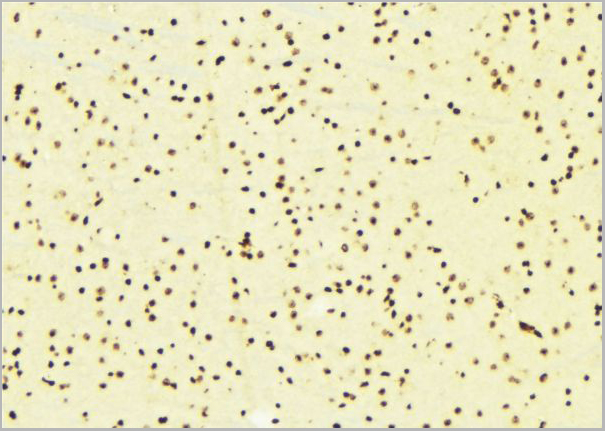 product-image-AAA31121_IHC2.jpg