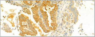 product-image-AAA31122_IHC2.jpg