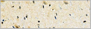 product-image-AAA31125_IHC5.jpg