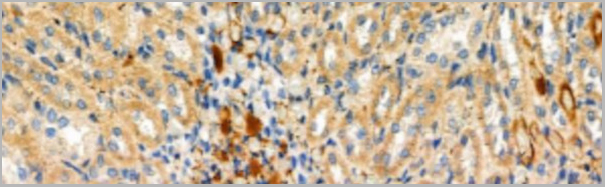 product-image-AAA31127_IHC5.jpg