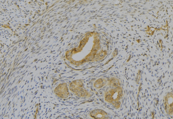 product-image-AAA31128_IHC2.jpg