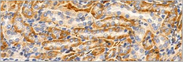 product-image-AAA31131_IHC3.jpg