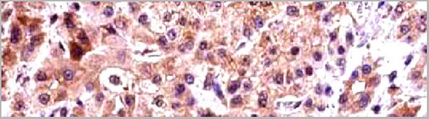 product-image-AAA31134_IHC2.jpg
