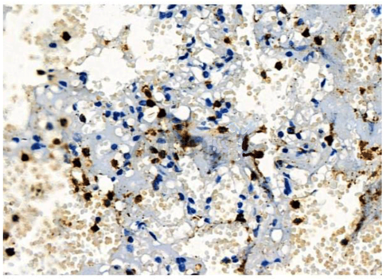 product-image-AAA31135_IHC3.jpg