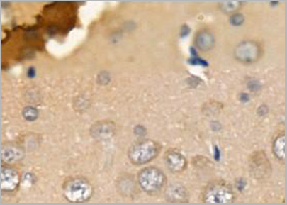 product-image-AAA31136_IHC2.png