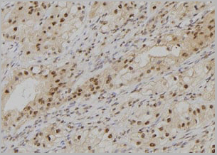 product-image-AAA31139_IHC2.jpg