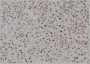 product-image-AAA31140_IHC3.jpg