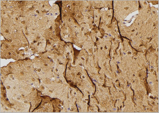 product-image-AAA31150_IHC2.jpg