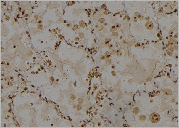 product-image-AAA31151_IHC3.jpg
