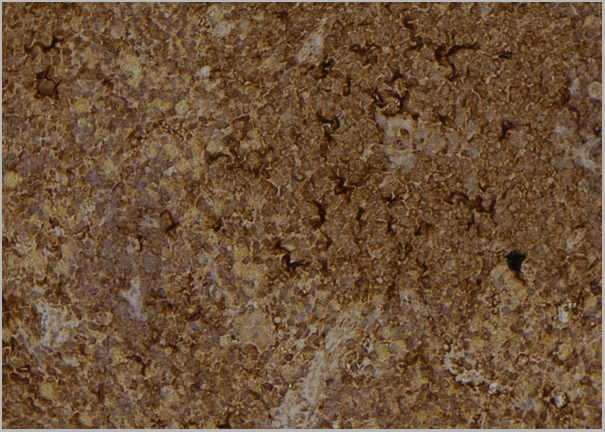 product-image-AAA31151_IHC4.jpg