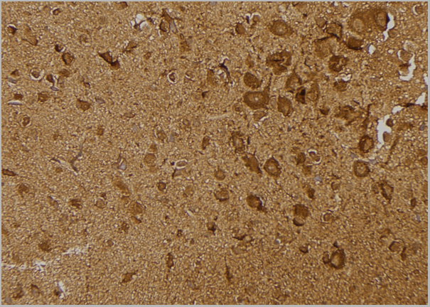 product-image-AAA31151_IHC5.jpg