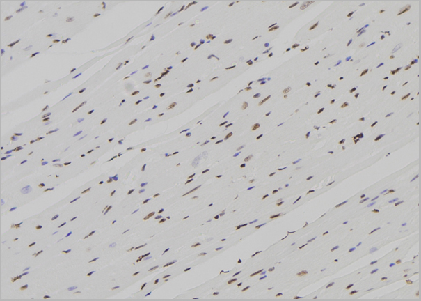 product-image-AAA31155_IHC.jpg