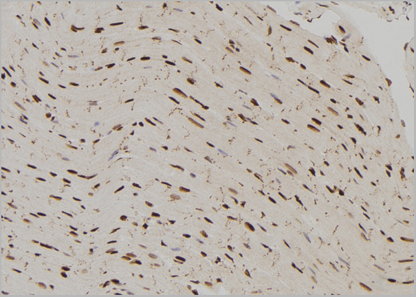 product-image-AAA31155_IHC2.jpg