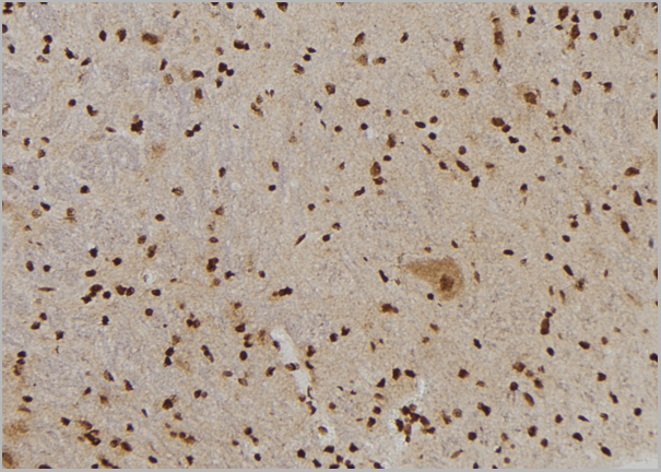 product-image-AAA31155_IHC3.jpg