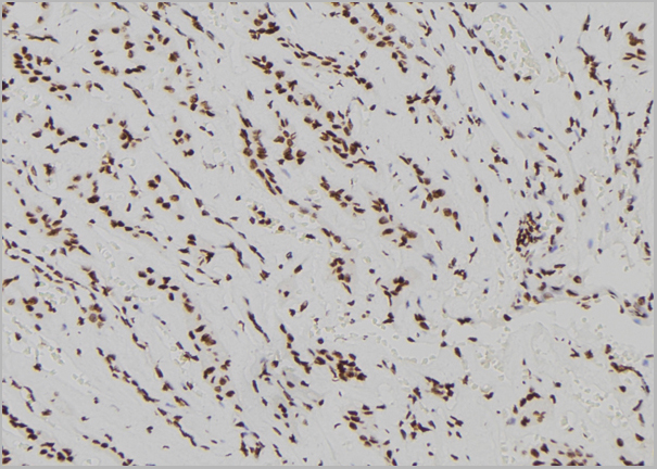 product-image-AAA31155_IHC4.jpg
