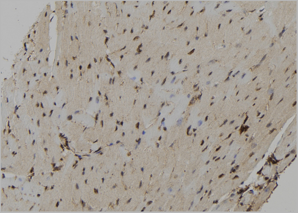 product-image-AAA31156_IHC.jpg