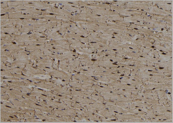 product-image-AAA31156_IHC2.jpg