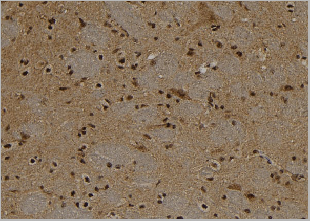 product-image-AAA31156_IHC3.jpg