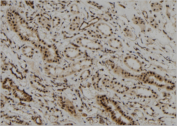 product-image-AAA31156_IHC4.jpg