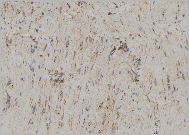 product-image-AAA31162_IHC2.jpg