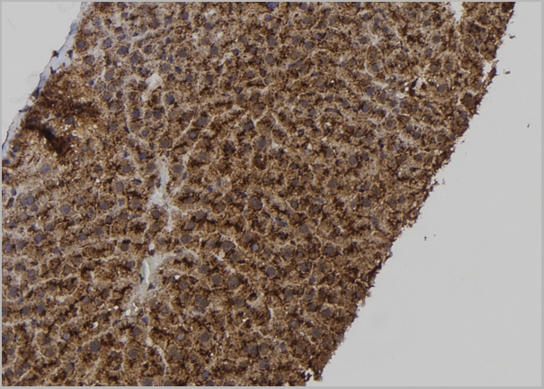 product-image-AAA31162_IHC3.jpg
