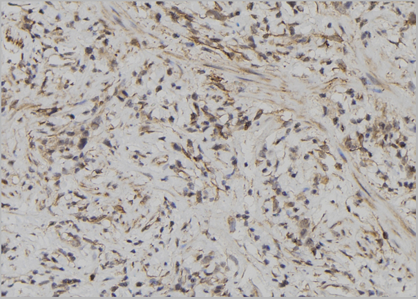 product-image-AAA31162_IHC4.jpg