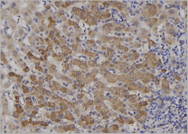 product-image-AAA31162_IHC5.jpg