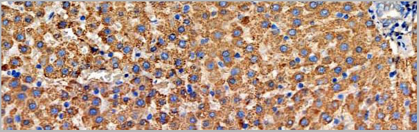 product-image-AAA31163_IHC3.jpg