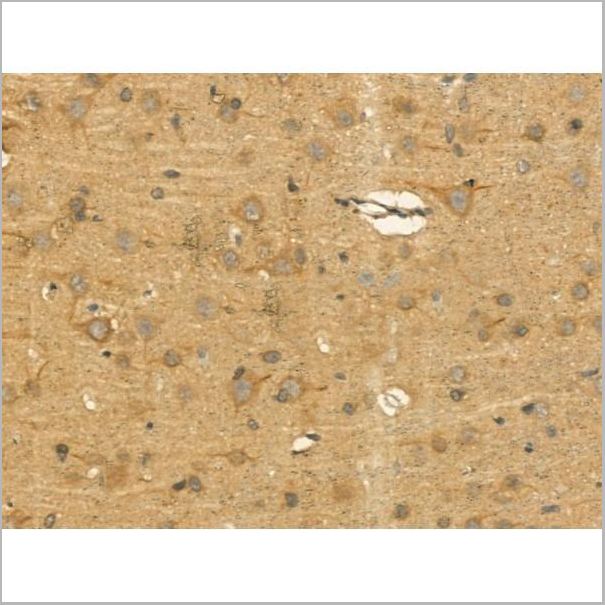 product-image-AAA31164_IHC3.jpg