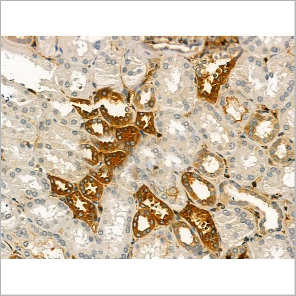 product-image-AAA31164_IHC8.jpg