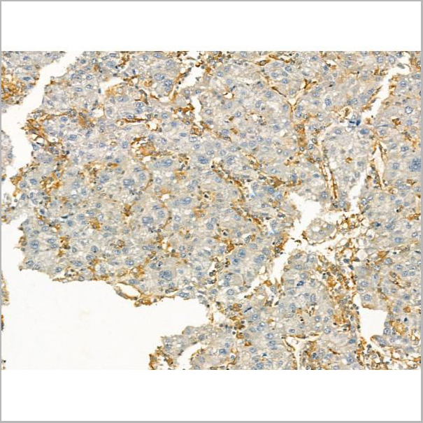 product-image-AAA31165_IHC2.jpg