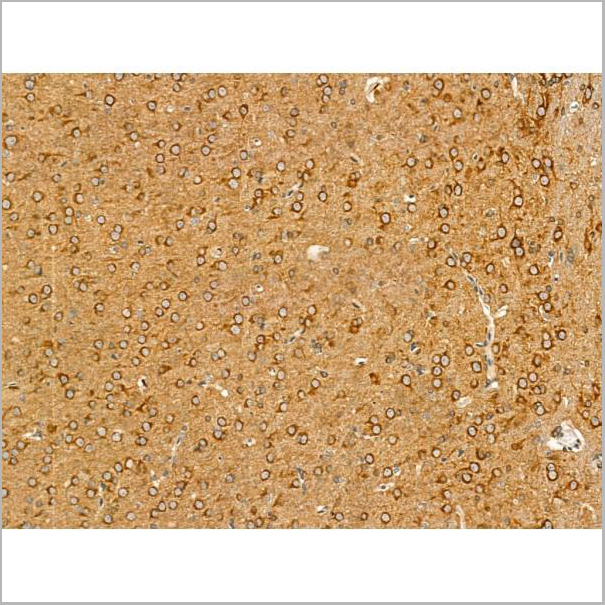 product-image-AAA31165_IHC3.jpg