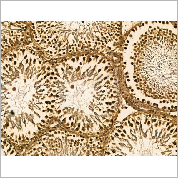 product-image-AAA31166_IHC2.jpg