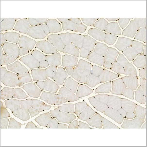product-image-AAA31166_IHC4.jpg