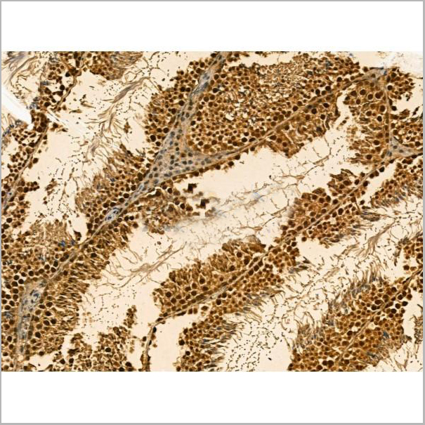 product-image-AAA31166_IHC5.jpg
