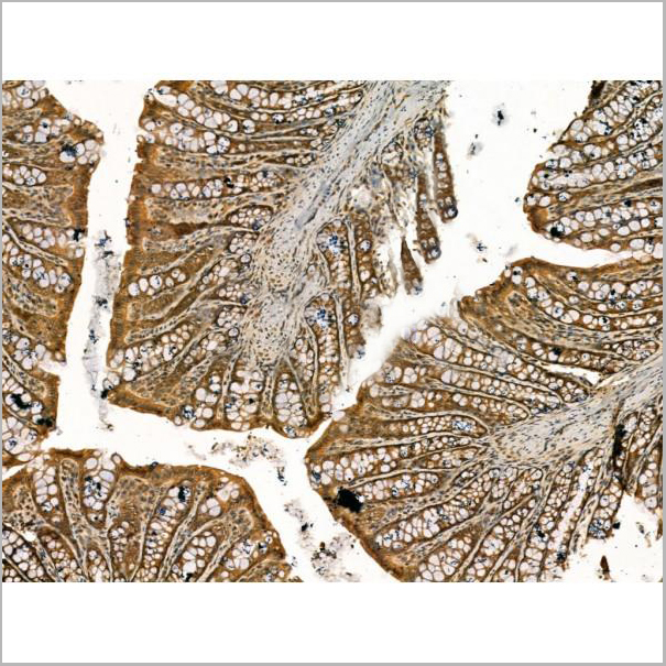 product-image-AAA31167_IHC2.jpg