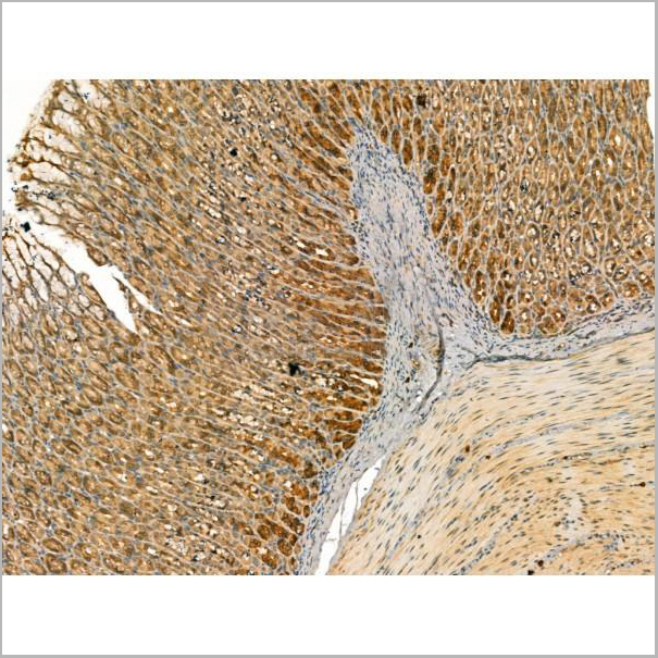 product-image-AAA31167_IHC3.jpg