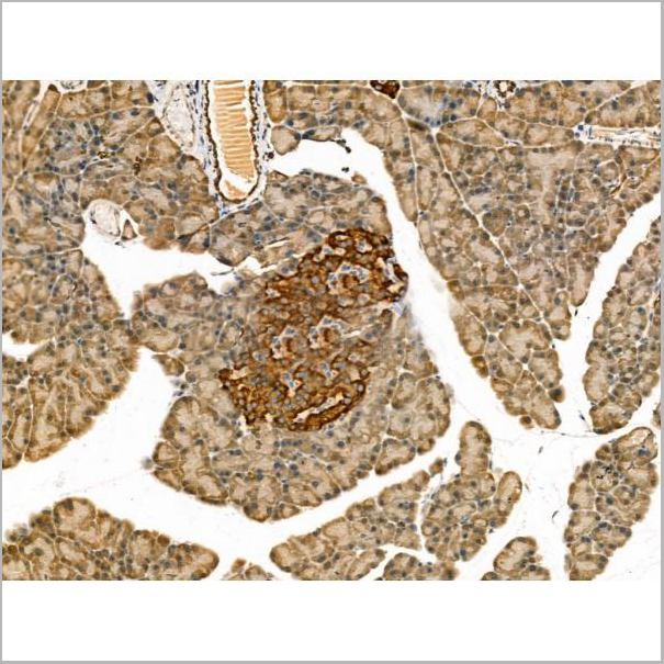 product-image-AAA31168_IHC2.jpg