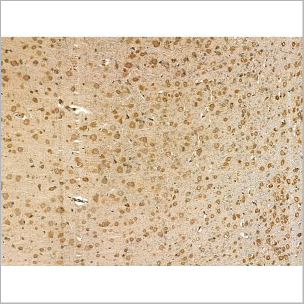 product-image-AAA31168_IHC3.jpg