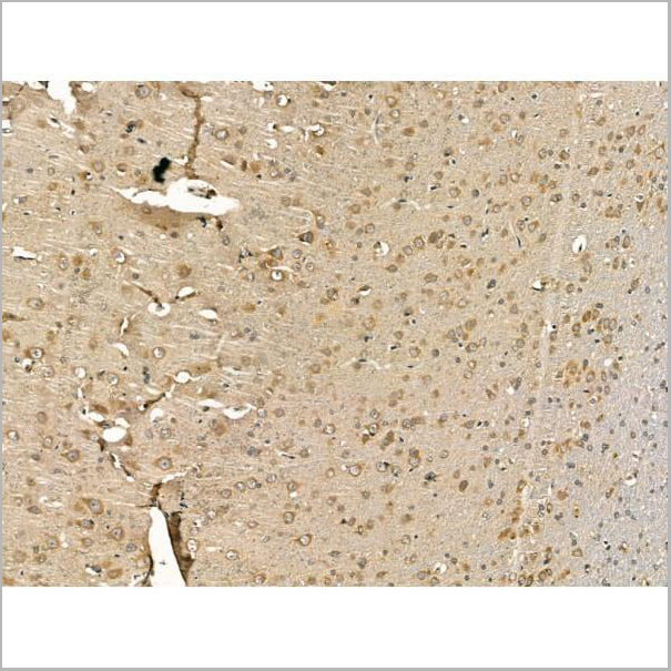 product-image-AAA31169_IHC2.jpg