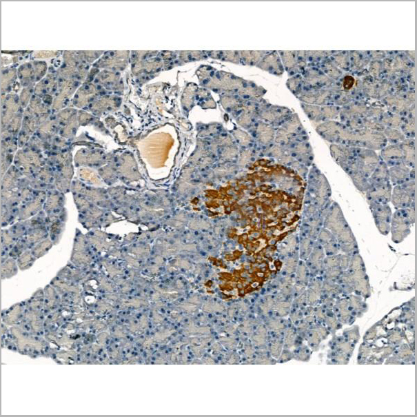 product-image-AAA31170_IHC2.jpg