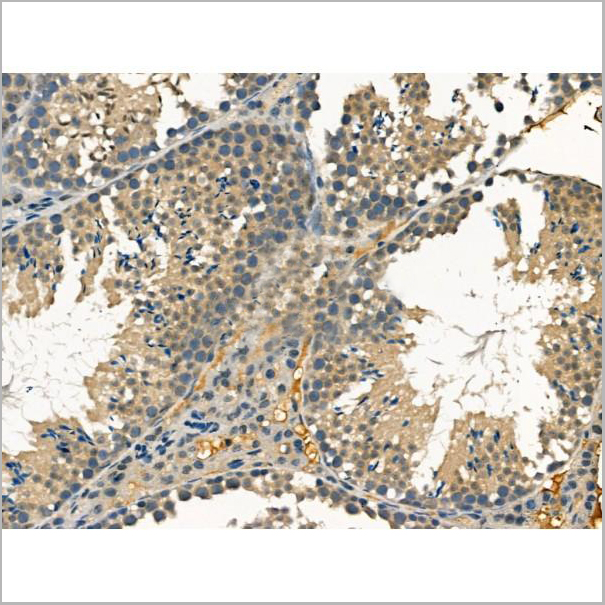 product-image-AAA31170_IHC3.jpg
