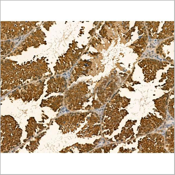 product-image-AAA31171_IHC6.jpg