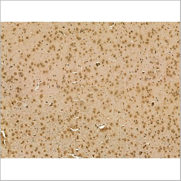 product-image-AAA31172_IHC3.jpg